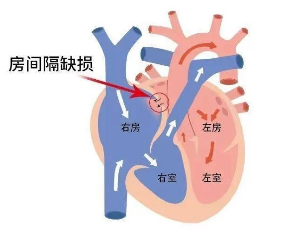 20240815c555e78be2a84d2fa2439ffead13d5ea_20240815562ed47fd6c5438992bf06221327cd3b.png